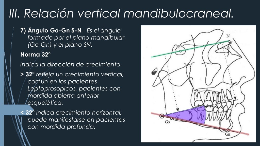 CEFALOMETRÍA DE STEINER