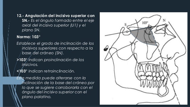 CEFALOMETRÍA DE STEINER