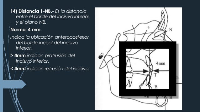 CEFALOMETRÍA DE STEINER