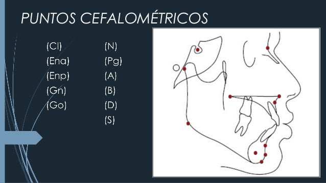 CEFALOMETRÍA DE STEINER
