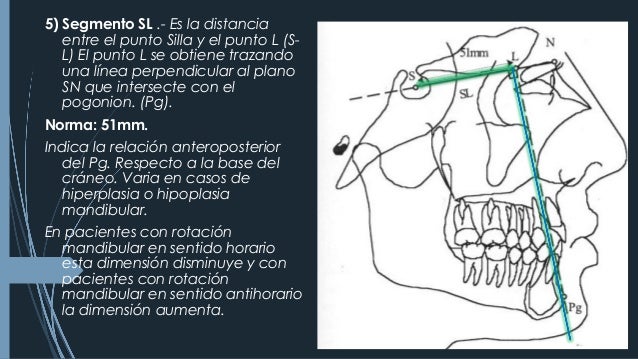 Puntos Cefalometricos Epub