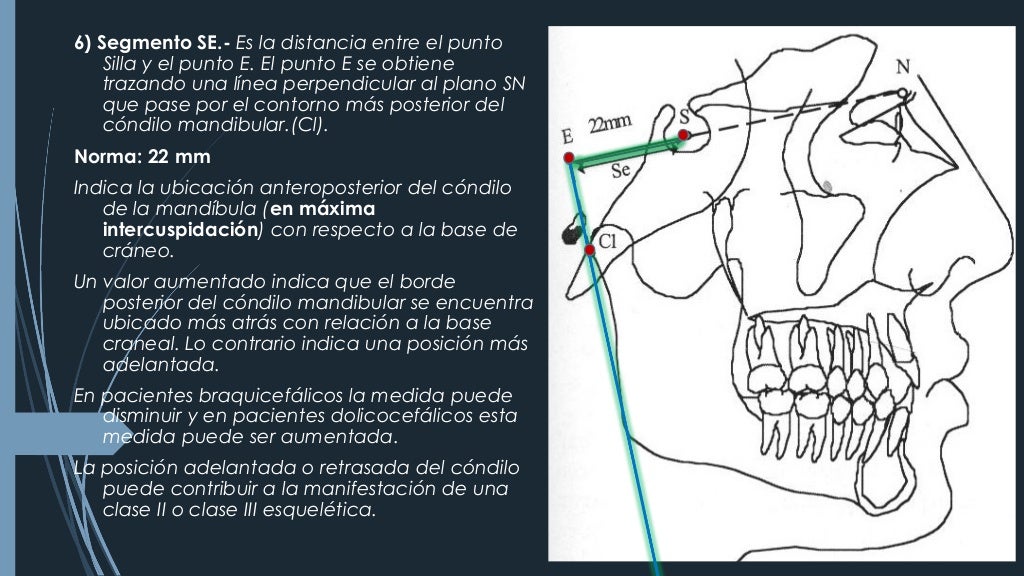 CEFALOMETRÍA DE STEINER