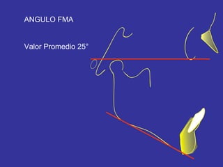 Análisis de tweed | PPT