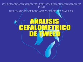 ANALISIS CEFALOMETRICO DE TWEED COLEGIO ODONTOLOGICO DEL PERU COLEGIO ODONTOLOGICO DE PUNO DIPLOMADO EN ORTODONCIA Y ORTOPEDIA MAXILAR  