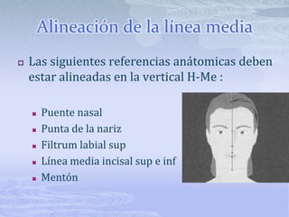Alineación de la línea mediaLas siguientes referencias anátomicas deben estar alineadas en la vertical H-Me :Puente nasalPunta de la narizFiltrum labial supLínea media incisalsup e infMentón 