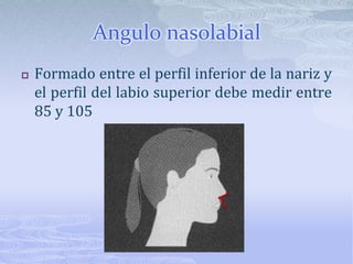 Nivel de la línea de sonrisaEl labio superior, al sonreir, no debe dejar expuesto más de 2mm de encía superiorLa exposición gingival depende deLargo del labio y de corona clínica del incisivo superiorAltura vertical maxilarMagnitud del movimiento de elevación del labio al sonreír 