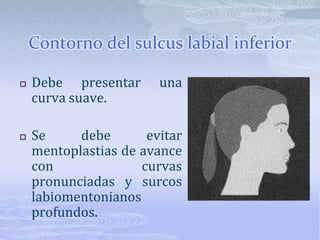 Para su corrección se debe considerar:Angulo existenteCorrección del la inclinación y posición del labio Estimación de la tensión labial Grosor de los labios