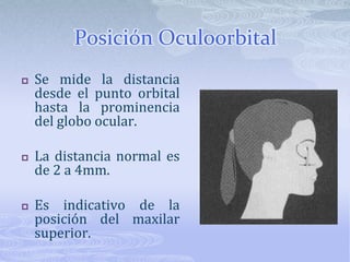 Contorno de sulcus del labio superiorEl sulcus debe presentar una curva suave, en caso de labios incompetentes presentan sulcus convexos al cierre labial.Importante: El maxilar no se debe retruir en curvas profundas