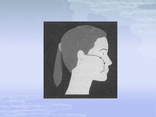 Posición OculoorbitalSe mide la distancia desde el punto orbital hasta la prominencia del globo ocular.La distancia normal es de 2 a 4mm.Es indicativo de la posición del maxilar superior.