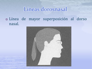 Plano Facial Línea que une los puntos glabela y pogonioncutáneo.