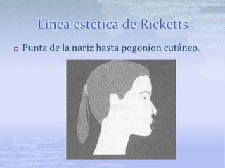 Línea nasofrontalLínea que parte de nasion cutáneo y es tangente a glabela.