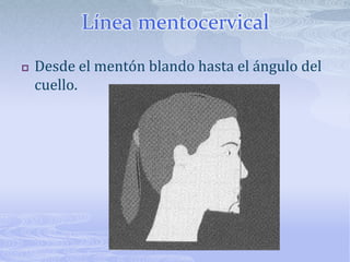 Líneas dorosnasalLínea de mayor superposición al dorso nasal.