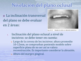 Relación del tamaño dentalEs importante que los segmentos dentales sean iguales entre sí.