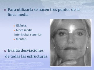 Nivelación del plano oclusalLa inclinación transversal del plano se debe evaluar en 2 áreas:Inclinación del plano oclusal a nivel de incisivos: se debe tener en cuenta:Largo de la corona de los incisivos: altura promedio 10-12mm, se comprueban poniendo modelo sobre superficie plana de no ser así se valora reconstrucción. Es importante considerar la abrasión.Altura del margen gingival.