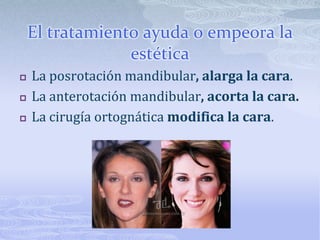 El tratamiento ayuda o empeora la estéticaLa posrotación mandibular, alarga la cara.La anterotación mandibular, acorta la cara.La cirugía ortognáticamodifica la cara.