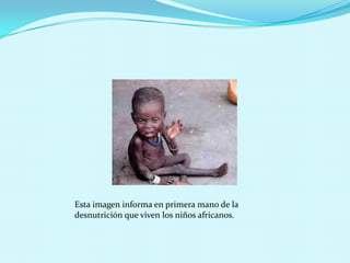 Esta imagen informa en primera mano de la
desnutrición que viven los niños africanos.
 