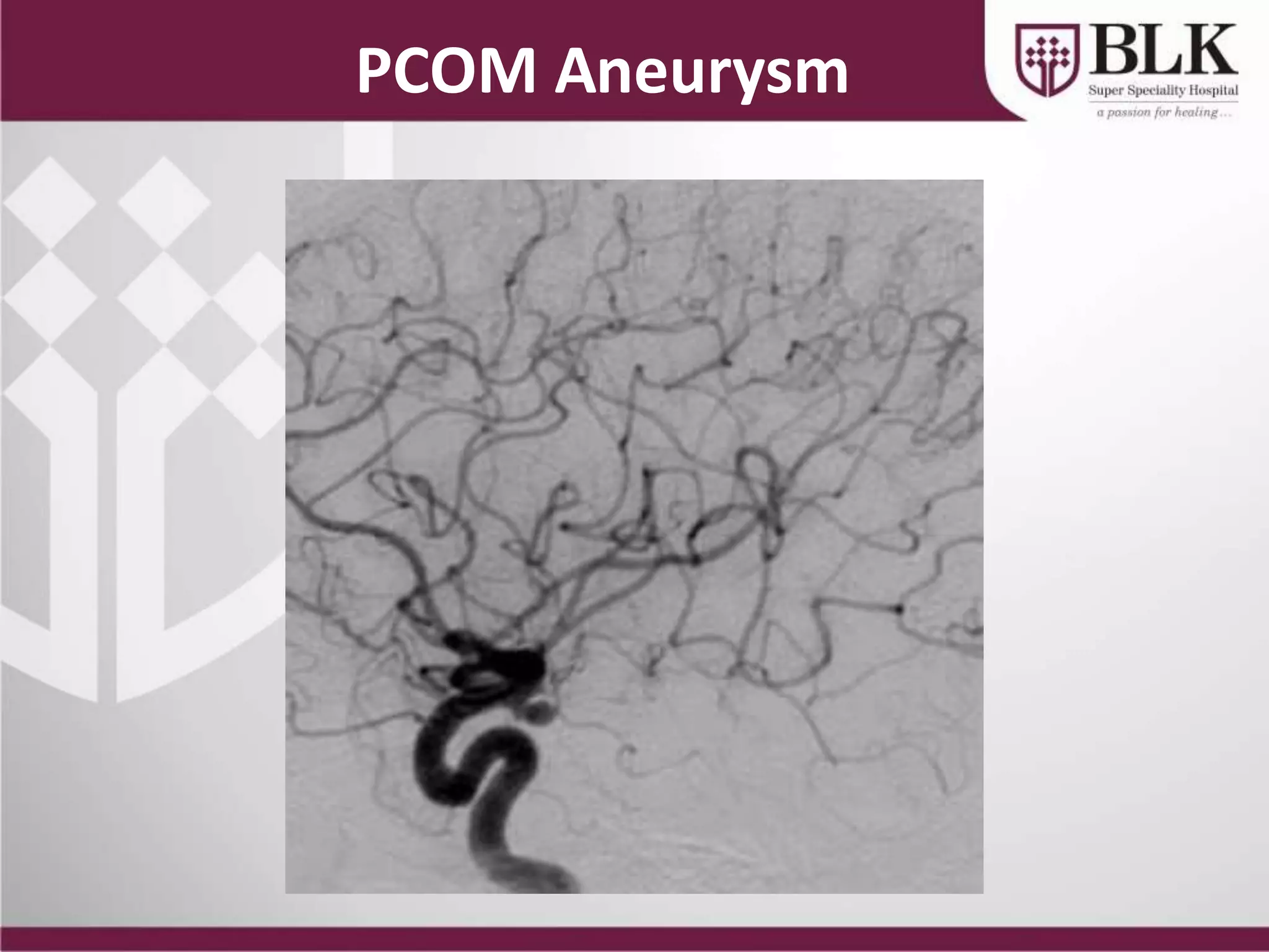 Pcom Radiology Vascular Interventions and their Clinical Applications | PPTX