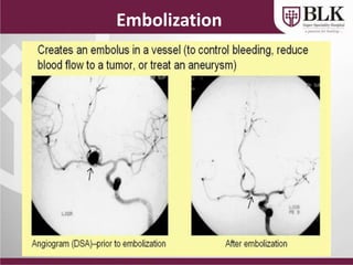 Vascular Interventions and their Clinical Applications | PPTX