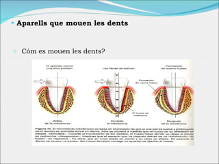 Aparells que mouen les dents Cóm es mouen les dents ? 