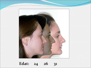 Edat:  24  26  31 