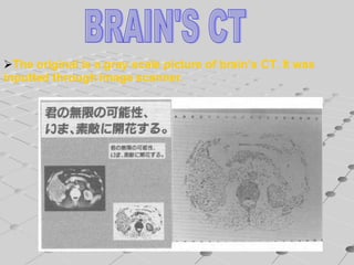 BRAIN'S CT The original is a gray scale picture of brain’s CT. It was  inputted through image scanner.  