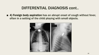 DIFFERENTIAL DIAGNOSIS cont..
■ 4) Foreign body aspiration has an abrupt onset of cough without fever,
often in a setting of the child playing with small objects.
23
 