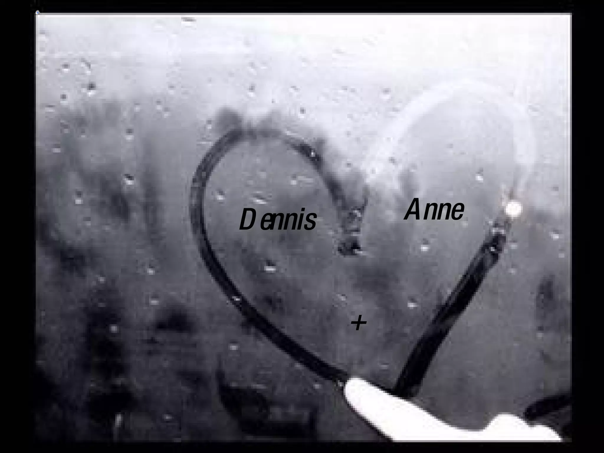 Anne + Dennis
