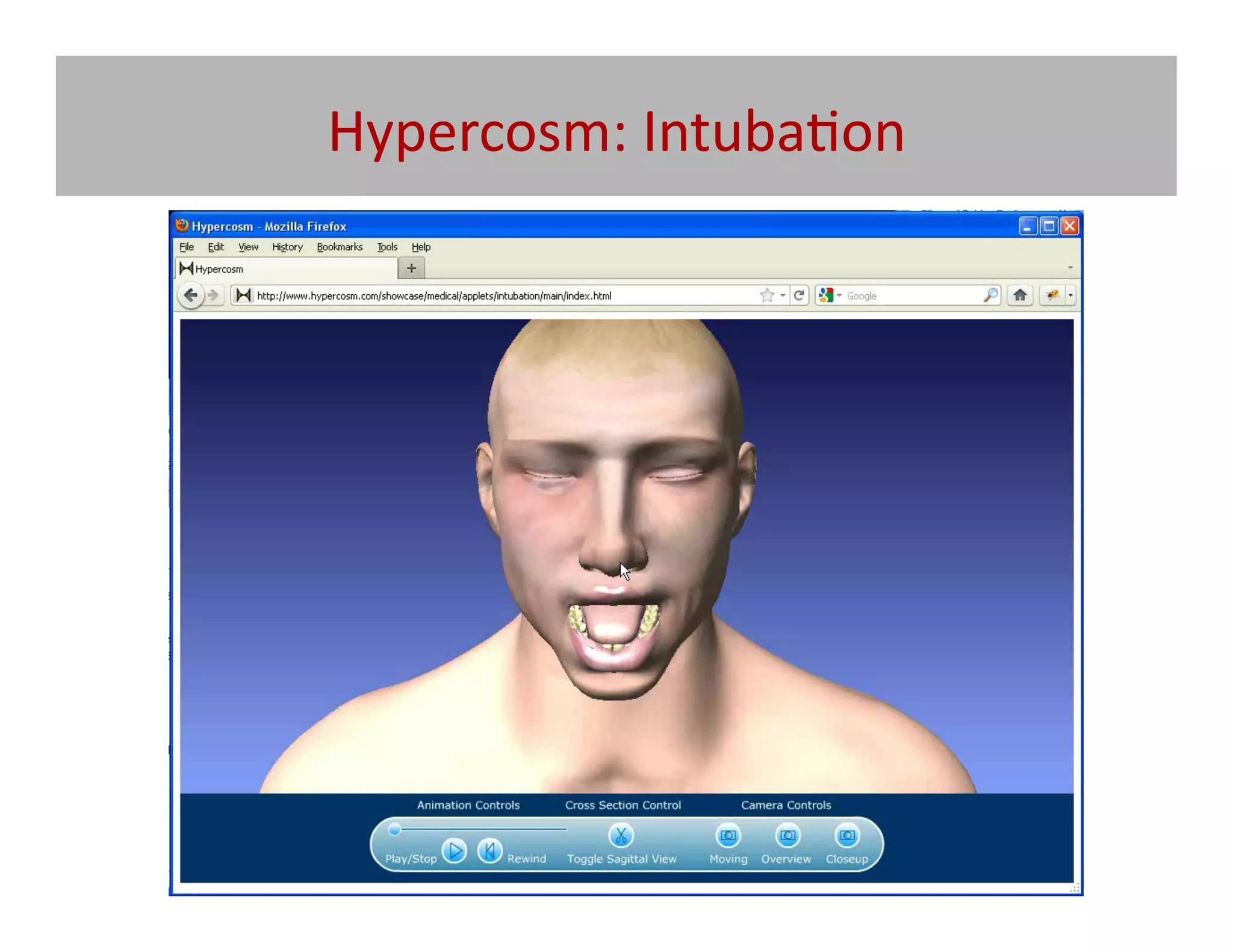 Hypercosm:	
  Intuba@on	
  
 