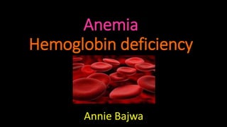 Anemia
Hemoglobin deficiency
Annie Bajwa
 
