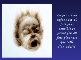 La peau d'un enfant est 10 fois plus sensible et prend feu 40 fois plus vite que celle d’un adulte  