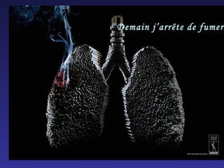 Demain j’arrête de fumer... 