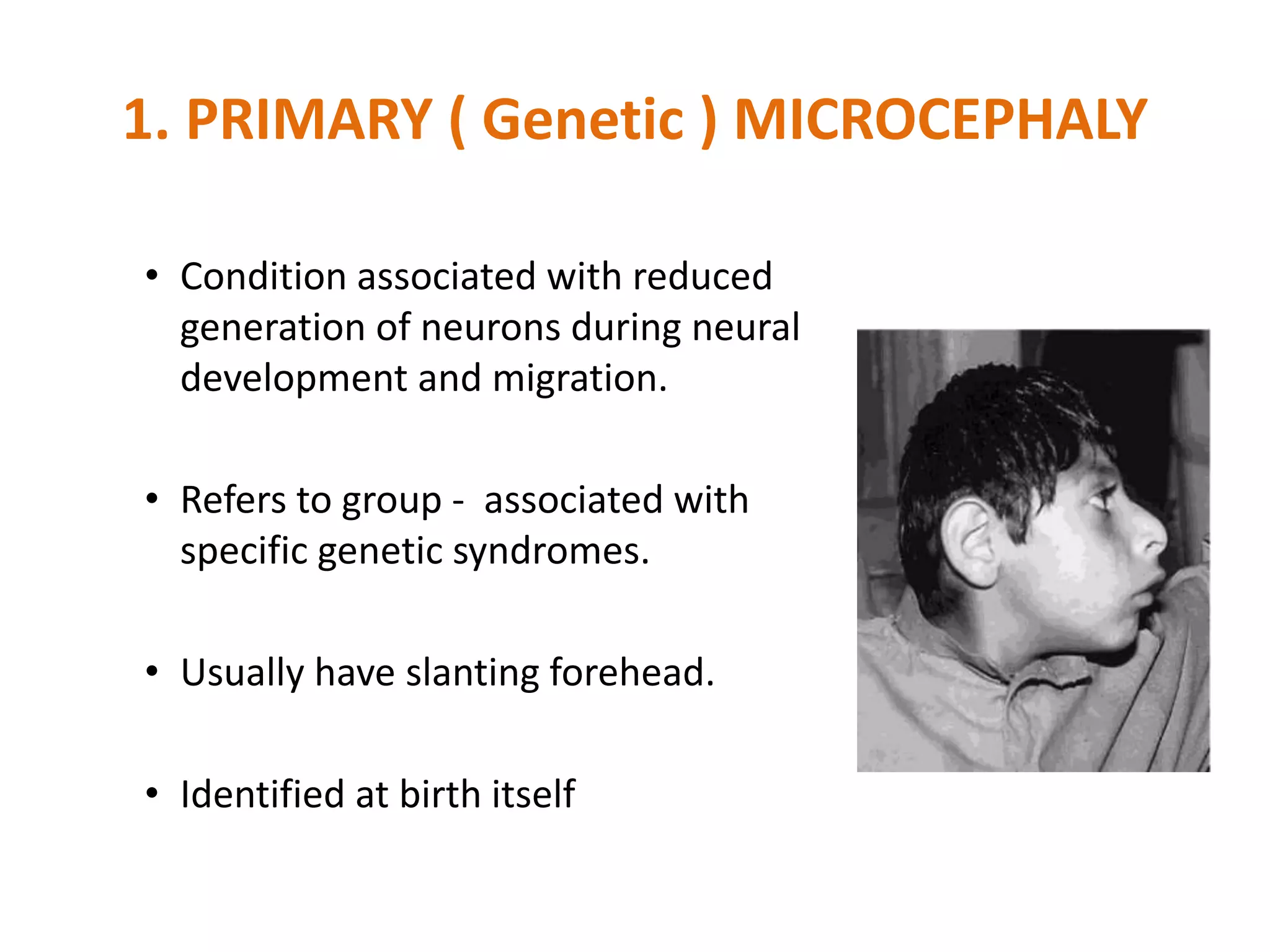 1. PRIMARY ( Genetic ) MICROCEPHALY
• Condition associated with reduced
generation of neurons during neural
development and migration.
• Refers to group - associated with
specific genetic syndromes.
• Usually have slanting forehead.
• Identified at birth itself
 