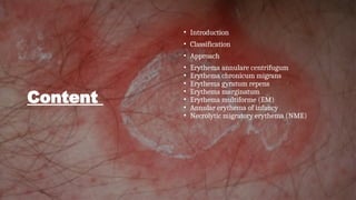 Annulaur Rash Diffuse Annular erythema .Annular erythema is a descriptive term that ...