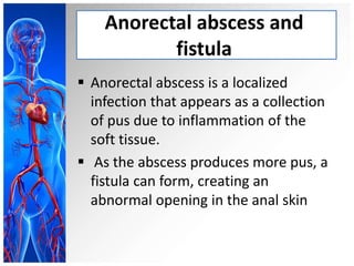 Ano rectal conditions | PPTX