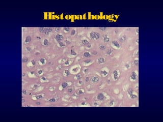 Histopathology

 