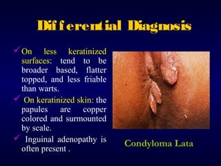 Dif f erential Diagnosis
 On

less keratinized
surfaces: tend to be
broader based, flatter
topped, and less friable
than warts.
 On keratinized skin: the
papules are copper
colored and surmounted
by scale.
 Inguinal adenopathy is
often present .

Condyloma Lata

 