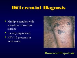Dif f erential Diagnosis
 Multiple papules with
smooth or verrucous
surface
 Usually pigmented
 HPV 16 presents in
most cases

Bowenoid Papulosis

 