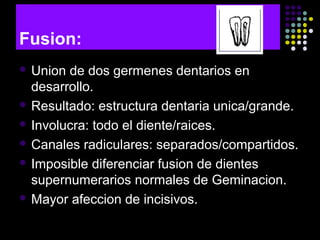 Fusion:
 Union de dos germenes dentarios en
desarrollo.
 Resultado: estructura dentaria unica/grande.
 Involucra: todo el diente/raices.
 Canales radiculares: separados/compartidos.
 Imposible diferenciar fusion de dientes
supernumerarios normales de Geminacion.
 Mayor afeccion de incisivos.
 