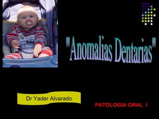 PATOLOGIA ORAL I
Dr Yader Alvarado
 