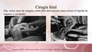 Cirugía fetal
Hay varios tipos de cirugías, entre ellos derivaciones para extraer el líquido de
órganos y cavidades.
Langman. (2016). Embriología Médica (13 ed.). (T. Sadler, Ed.) China: Wolters Kluwer.
 