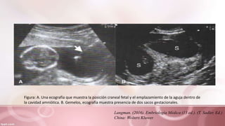 Figura: A. Una ecografía que muestra la posición craneal fetal y el emplazamiento de la aguja dentro de
la cavidad amniótica. B. Gemelos, ecografía muestra presencia de dos sacos gestacionales.
Langman. (2016). Embriología Médica (13 ed.). (T. Sadler, Ed.)
China: Wolters Kluwer.
 