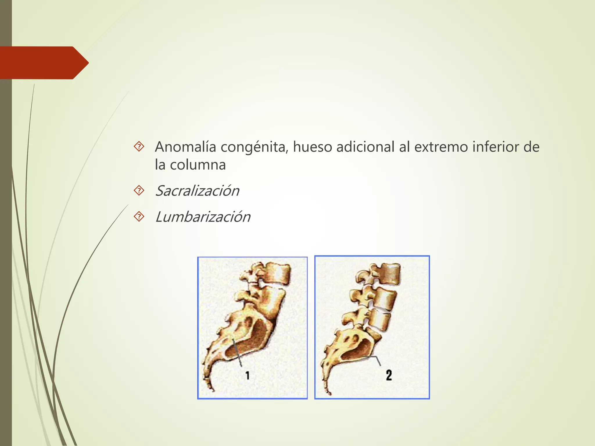 Anomal as De La Columna Lumbosacra espina B fida V rtebra anomal-as-de-la-columna-lumbosacra-espina-b-fida-v-rtebra