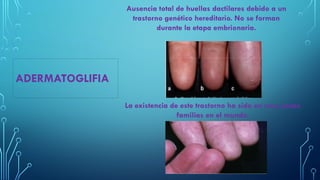 Anomal as DactilareS PPTX anomal-as-dactilares-pptx
