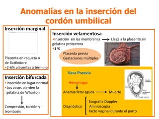 Anomalías en la inserción del
             cordón umbilical
Inserción marginal
                             Inserción vela...