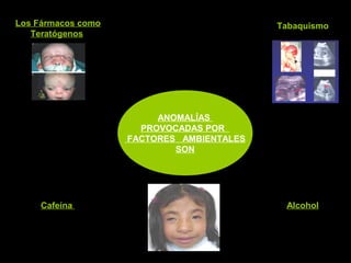 ANOMALÍAS
PROVOCADAS POR
FACTORES AMBIENTALES
SON
Los Fármacos como
Teratógenos
Tabaquismo
Cafeína Alcohol
 
