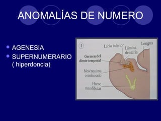 ANOMALÍAS DE NUMERO
 AGENESIA
 SUPERNUMERARIO
( hiperdoncia)
 