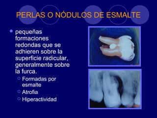PERLAS O NÓDULOS DE ESMALTE
 pequeñas
formaciones
redondas que se
adhieren sobre la
superficie radicular,
generalmente sobre
la furca.
 Formadas por
esmalte
 Atrofia
 Hiperactividad
 