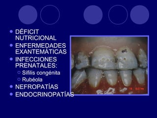  DÉFICIT
NUTRICIONAL
 ENFERMEDADES
EXANTEMÁTICAS
 INFECCIONES
PRENATALES:
 Sífilis congénita
 Rubéola
 NEFROPATÍAS
 ENDOCRINOPATÍAS
 
