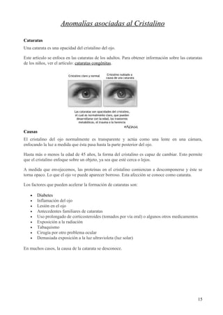 Anomalías en estructura interna del ojo
