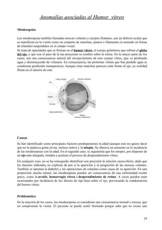 Anomalías en estructura interna del ojo
